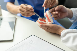 Close-up 3d model of a dental implant.