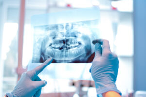 Close-up of female doctor pointing at teeth x-ray image at dental office.